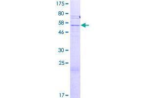 SLC25A31 Protein (AA 1-315) (GST tag)