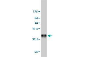 Western Blot detection against Immunogen (35. (DAPK2 antibody  (AA 281-370))