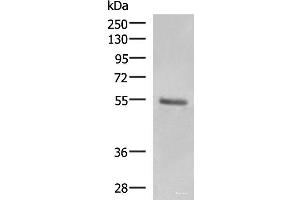 Western blot analysis of Human skin tissue lysate using KRT36 Polyclonal Antibody at dilution of 1:1000