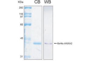10% SDS-PAGE stained with Coomassie Blue (CB), immunobloting with anti-6xHis (WB) serum and peptide fingerprinting by MALDI-TOF-TOF mass spectrometry (Annexin A2 Protein (ANXA2) (AA 1-339) (His tag))
