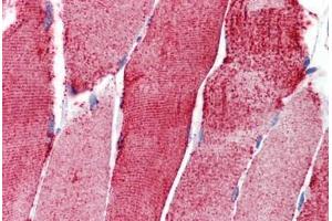 Human Skeletal Muscle: Formalin-Fixed, Paraffin-Embedded (FFPE) (ACTN3 antibody  (AA 180-229))