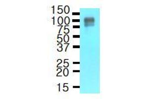 Western Blotting (WB) image for anti-Amyloid beta (A4) Precursor Protein (APP) (AA 18-289) antibody (ABIN317497) (APP antibody  (AA 18-289))