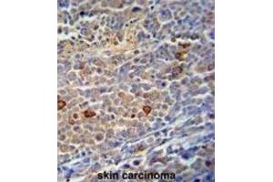Immunohistochemistry (IHC) image for anti-Chromosome 9 Open Reading Frame 156 (C9orf156) antibody (ABIN3002894) (C9orf156 antibody)