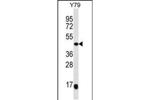 Western blot analysis in Y79 cell line lysates (35ug/lane). (MAP2K4 antibody  (C-Term))