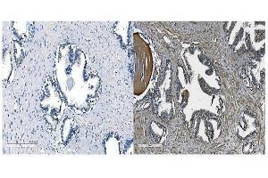 IHC analysis of OB Cadherin/CDH11 using anti-OB Cadherin/CDH11 antibody (ABIN5518978). (OB Cadherin antibody  (AA 55-293))