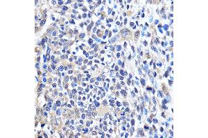 Immunohistochemistry of paraffin-embedded Human esophageal using CDK6 Rabbit pAb (ABIN7266595) at dilution of 1:100 (40x lens).