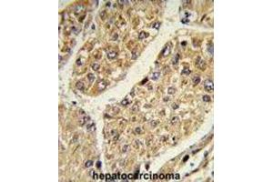 Immunohistochemistry (IHC) image for anti-Chondroitin Sulfate N-Acetylgalactosaminyltransferase 2 (CSGALNACT2) antibody (ABIN3003905) (CSGALNACT2 antibody)