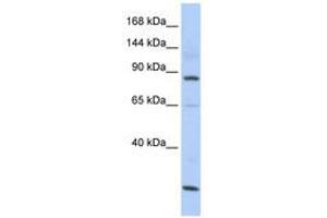 Image no. 1 for anti-MutS Homolog 5 (MSH5) (AA 107-156) antibody (ABIN6740728) (MSH5 antibody  (AA 107-156))