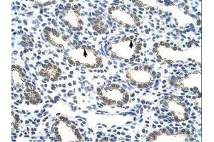 Image no. 1 for anti-Keratin 18 (KRT18) (C-Term) antibody (ABIN203132)