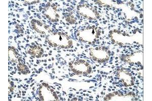 Image no. 1 for anti-Keratin 18 (KRT18) (C-Term) antibody (ABIN203132) (Cytokeratin 18 antibody  (C-Term))