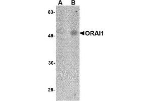 Western Blotting (WB) image for anti-ORAI Calcium Release-Activated Calcium Modulator 1 (ORAI1) (C-Term) antibody (ABIN492546) (ORAI1 antibody  (C-Term))
