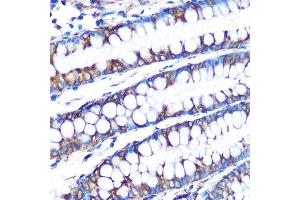 Immunohistochemistry of paraffin-embedded human colon using LOX Rabbit mAb (ABIN7268347) at dilution of 1:100 (40x lens). (LOX antibody)