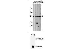 Image no. 1 for anti-Tumor Protein P53 (TP53) (pThr18) antibody (ABIN358195) (p53 antibody  (pThr18))