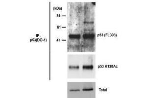 Western Blotting (WB) image for anti-Tumor Protein P53 (TP53) antibody (ABIN1449254) (p53 antibody)