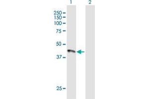 Western Blot analysis of HFE expression in transfected 293T cell line by HFE MaxPab polyclonal antibody. (HFE antibody  (AA 1-348))