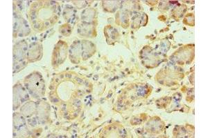 Immunohistochemistry of paraffin-embedded human pancreatic tissue using ABIN7172857 at dilution of 1:100 (TRPM2 antibody  (AA 1204-1503))