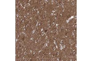 Immunohistochemical staining (Formalin-fixed paraffin-embedded sections) of human hippocampus with ADCY2 polyclonal antibody  shows strong cytoplasmic positivity in neuronal cells. (ADCY2 antibody)