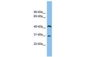 Image no. 1 for anti-Adenosine Deaminase (ADA) (AA 71-120) antibody (ABIN6744916) (ADA antibody  (AA 71-120))