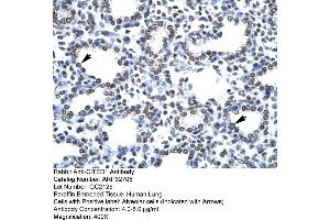 Human Lung (CITED1 antibody  (Middle Region))