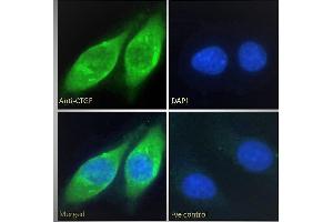 ABIN6391343 Immunofluorescence analysis of paraformaldehyde fixed HepG2 cells, permeabilized with 0. (CTGF antibody  (AA 111-123))