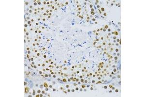 Immunohistochemistry of paraffin-embedded mouse testis using SNRNP70 antibody. (SNRNP70 antibody  (AA 150-250))