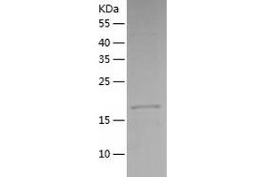 Western Blotting (WB) image for Mesoderm Development Candidate 2 (MESDC2) (AA 34-234) protein (His tag) (ABIN7123917)