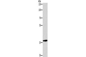 Gel: 8 % SDS-PAGE, Lysate: 40 μg, Lane: Hela cells, Primary antibody: ABIN7190518(DUSP2 Antibody) at dilution 1/300, Secondary antibody: Goat anti rabbit IgG at 1/8000 dilution, Exposure time: 1 minute