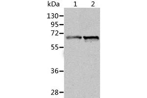 Western Blot analysis of Human fetal liver and liver cancer tissue using ALDH4A1 Polyclonal Antibody at dilution of 1:450 (ALDH4A1 antibody)