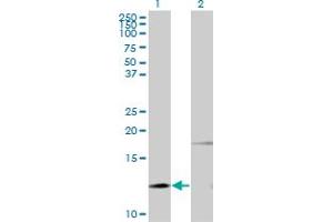 Western Blot analysis of PTH expression in transfected 293T cell line by PTH monoclonal antibody (M11), clone 3G9. (PTH antibody  (AA 32-115))