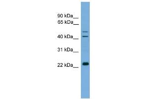 WB Suggested Anti-CHP Antibody Titration: 0. (CHP antibody  (N-Term))
