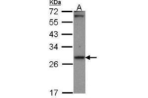 WB Image Sample (30 ug of whole cell lysate) A: A431 , 12% SDS PAGE Carbonyl reductase 1 antibody antibody diluted at 1:1000 (CBR1 antibody  (C-Term))