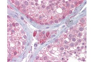 Anti-UBE2L3 antibody IHC of human testis. (UBE2L3 antibody  (AA 35-84))