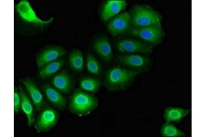 Immunofluorescent analysis of A549 cells using ABIN7167819 at dilution of 1:100 and Alexa Fluor 488-congugated AffiniPure Goat Anti-Rabbit IgG(H+L) (RAI1 antibody  (AA 617-823))