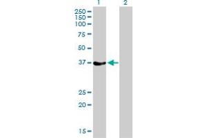 Western Blot analysis of RAD51 expression in transfected 293T cell line by RAD51 monoclonal antibody (M01), clone 2E5-E5. (RAD51 antibody  (AA 1-242))