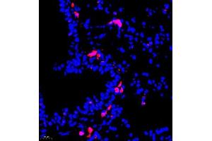 Immunofluorescence of paraffin embedded mouse lung using MHC-II (ABIN7074245) at dilution of 1:500 (400x lens) (CD74 antibody)