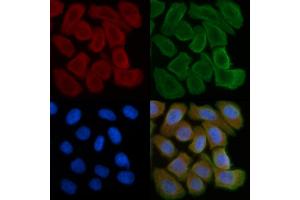 ABIN6259185 and ABIN6274510 staining Hela cells(30 min of UV treatment) by IF/ICC.