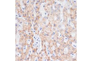 Immunohistochemistry of paraffin-embedded human liver using AREG antibody (ABIN6127431, ABIN6137065, ABIN6137066 and ABIN6216408) at dilution of 1:100 (40x lens). (Amphiregulin antibody  (AA 20-252))