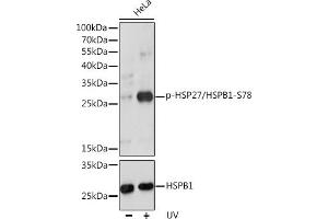 Western blot analysis of extracts of HeLa cells, using Phospho-HSP27/HSPB1-S78 pAb (ABIN3019892, ABIN3019893, ABIN3019894 and ABIN1681665) at 1:1000 dilution or HSP27/HSPB1 antibody (ABIN7267568). (HSP27 antibody  (pSer78))