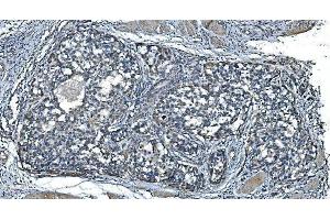 IHC analysis of TIMM8A/DDP using anti-TIMM8A/DDP antibody (ABIN7600039).