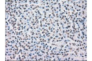 Image no. 3 for anti-Checkpoint Kinase 2 (CHEK2) antibody (ABIN1497498) (CHEK2 antibody)