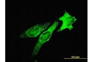 Immunofluorescence (IF) image for anti-Tumor Susceptibility Gene 101 (TSG101) antibody (ABIN781822) (TSG101 antibody)