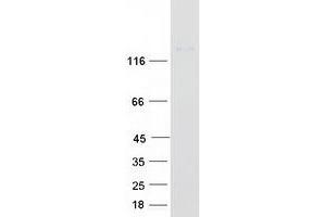 Western Blotting (WB) image for rho GTPase Activating Protein 29 (ARHGAP29) protein (Myc-DYKDDDDK Tag) (ABIN2714881)