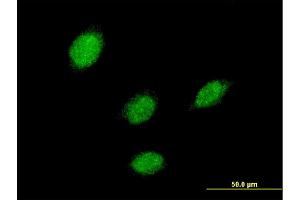 Immunofluorescence of monoclonal antibody to LHX5 on HeLa cell. (LHX5 antibody  (AA 136-235))