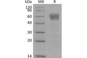 Western Blotting (WB) image for Interleukin 3 Receptor, alpha (IL3RA) protein (Fc Tag) (ABIN7321046) (IL3RA Protein (Fc Tag))