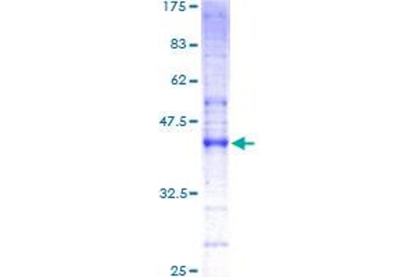 IFITM3 Protein (AA 1-133) (GST tag)