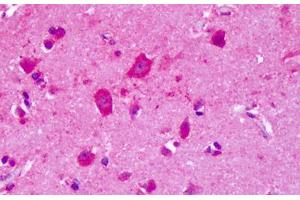 GRM8 antibody  (N-Term)