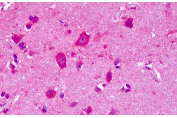 GRM8 antibody  (N-Term)