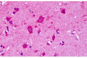 Anti-GRM8 / MGLUR8 antibody IHC staining of human brain, cortex.