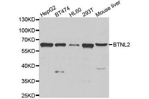 Western blot analysis of extracts of various cell lines, using BTNL2 antibody. (BTNL2 antibody  (AA 246-455))