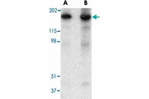 Western blot analysis of RTN4 in mouse brain tissue lysate with RTN4 polyclonal antibody  at (A) 0. (Reticulon 4 antibody  (N-Term))